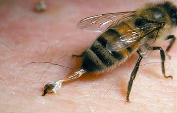 مرجع فروش زهر زنبور عسل