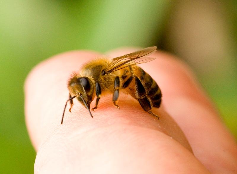 علائم حساسیت به نیش زنبور عسل